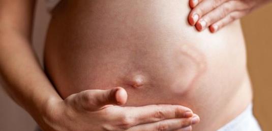 女性在分娩之后会经历7个不常见的身体变化