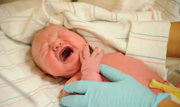 宝宝刚生下来，医生会做哪些事情？