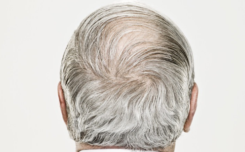 白发用什么染发最安全-五十岁白头发不染怎么办